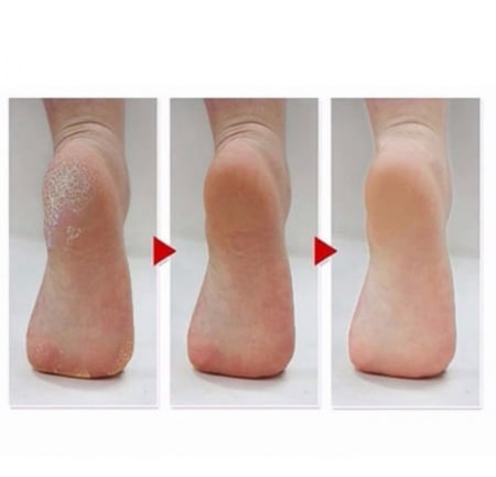 جوارب لتقشير  القدمين من - ام بيوتي