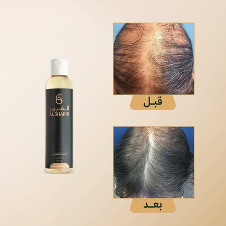 زيت الغَرير الطبيعي لتقوية وتكثيف الشعر