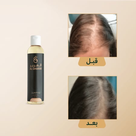 زيت الغَرير الطبيعي لتقوية وتكثيف الشعر