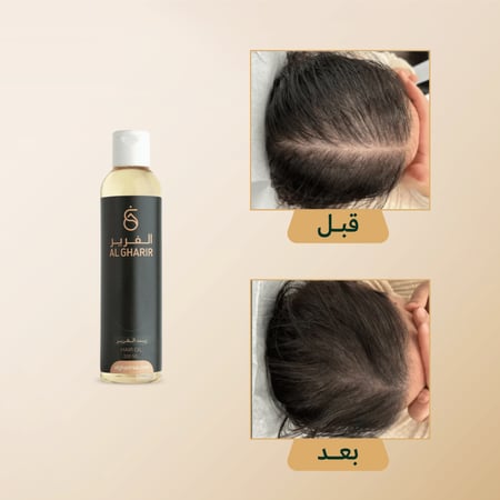 زيت الغَرير الطبيعي لتقوية وتكثيف الشعر
