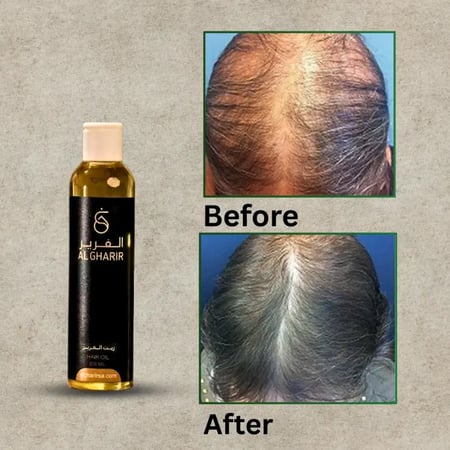 زيت الغَرير الطبيعي لتقوية وتكثيف الشعر