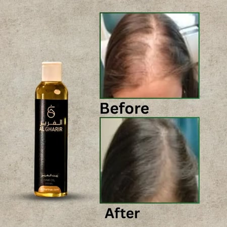زيت الغَرير الطبيعي لتقوية وتكثيف الشعر