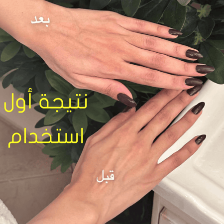 2X كريم تفتيح البشرة