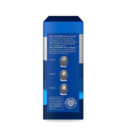 تساقط الشعر