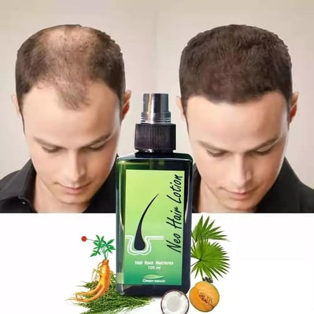 new hair lotion