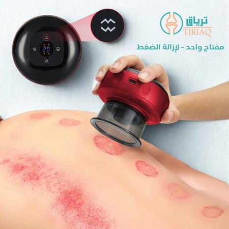 Dry cupping therapy