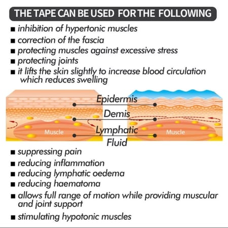 Kinesiology tape