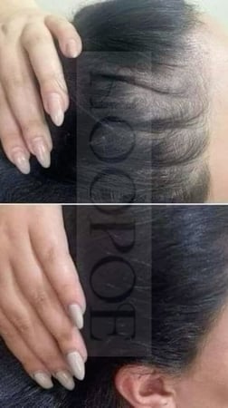 مجموعة السدر ونواة التمر للعناية الشاملة بالشعر