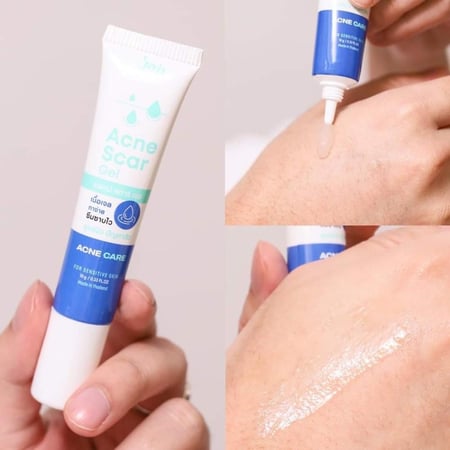 جوجي جل علاج ندبات حب الشباب JOJI Acne Scar Gel
