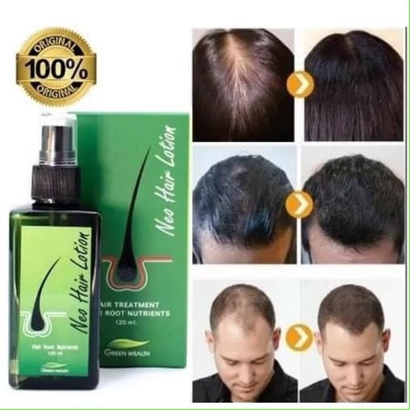 Neo Hair Lotion نيو هير لوشن