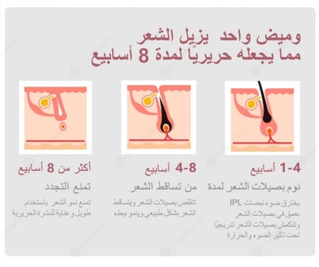 جهاز إزالة الشعر ليزر ملاي الياقوت T10 المطور