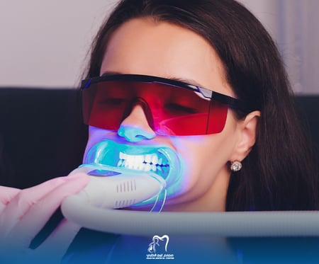 توريد اللثة بالليزر