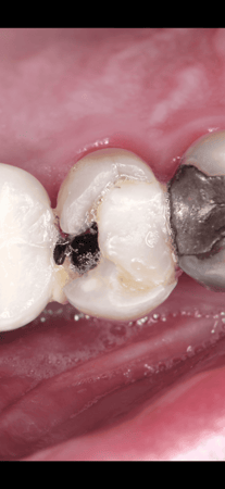 كاميرا نيكون D3100 نظيفة مع عدسة ماكرو + اضاءة