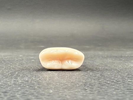 Endo molar access cavity