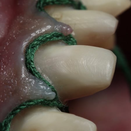 Retraction Cord