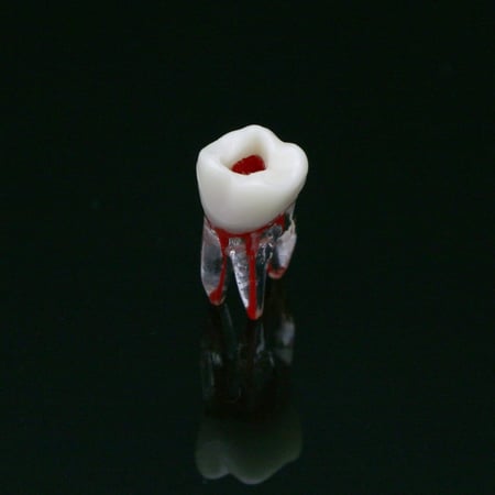 Endo tooth plastic
