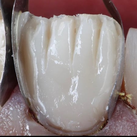 shofu Dentin composite A20