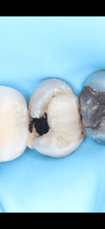 كاميرا نيكون D3100 نظيفة مع عدسة ماكرو + اضاءة