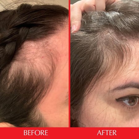 هيرتامين جيمي ستار لنمو الشعر والأظافر بسرعة للنساء والرجال - 60 علكة