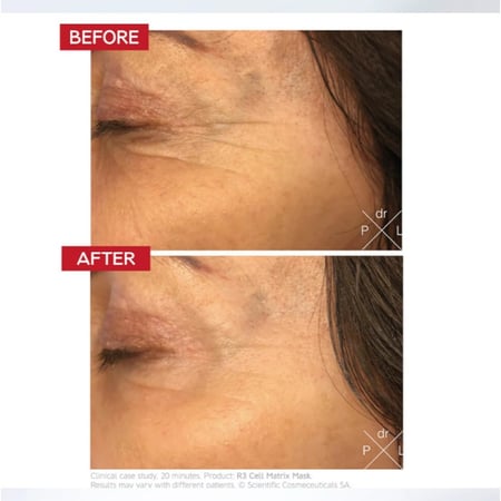 طقم العناية بالبشرة دكتور ليفي قناع شد البشرة - قناع ترطيب البشرة