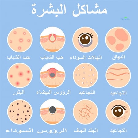 كريم لتفتيح الأماكن الداكنة بالجسم بيجما نورم 30 جم