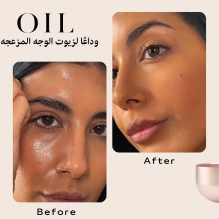 ازالة دهون الوجه