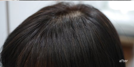 شامبو eo fortifying