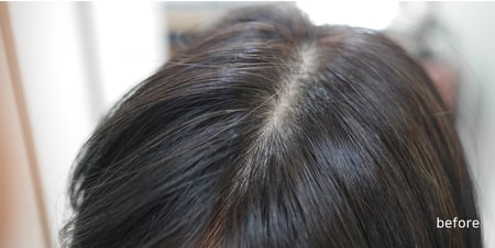 شامبو للشعر الدهني