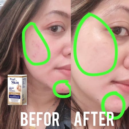 حبوب بيرل سكن كولاجين للتفتيح والنضارة   60 كبسوله