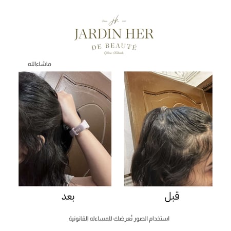 زيت الإنبات