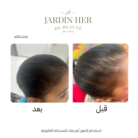 زيت الإنبات