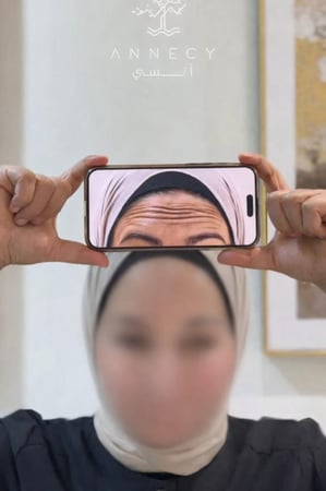 عرض بوتكس وجه كامل مع رتوش