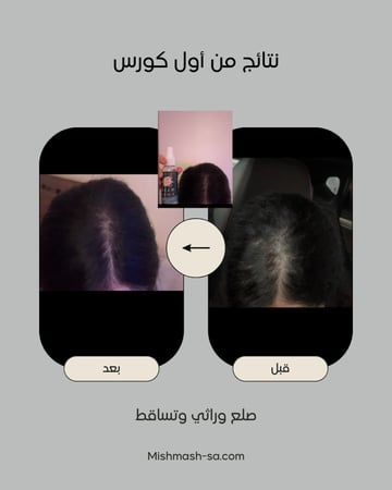 ZERO.10  عبوتين حجم العبوة الواحدة ٥٠ مل