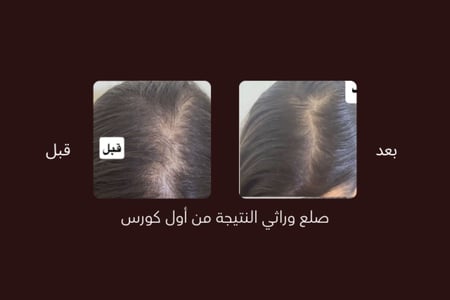 ZERO.10  عبوتين حجم العبوة الواحدة ٥٠ مل