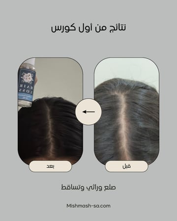 ZERO.10  عبوتين حجم العبوة الواحدة ٥٠ مل