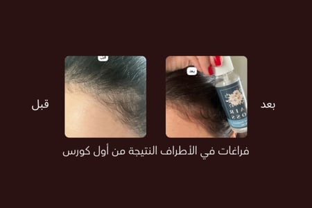 ZERO.10  عبوتين حجم العبوة الواحدة ٥٠ مل