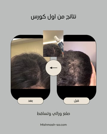 ZERO.10  عبوتين حجم العبوة الواحدة ٥٠ مل