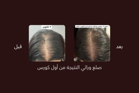 ZERO.10  عبوتين حجم العبوة الواحدة ٥٠ مل