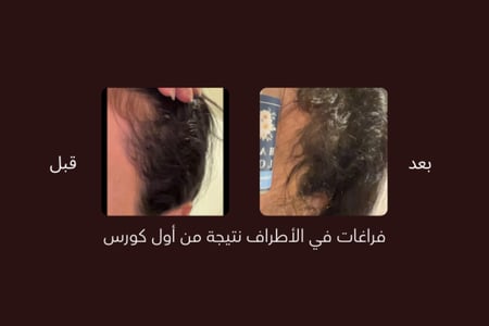 ZERO.10  عبوتين حجم العبوة الواحدة ٥٠ مل