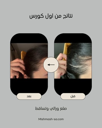 ZERO.10  عبوتين حجم العبوة الواحدة ٥٠ مل