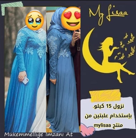 كبسولات ماي ليزا للتنحيف