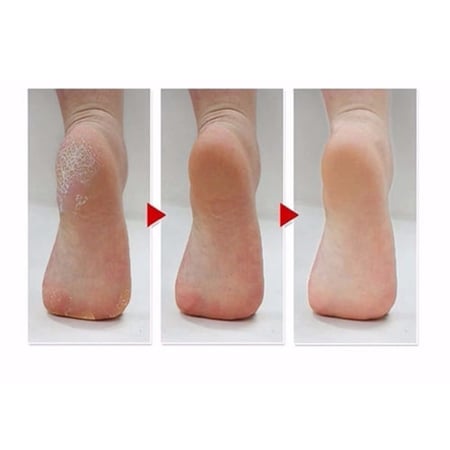 جوارب تقشير القدمين من ام بيوتي