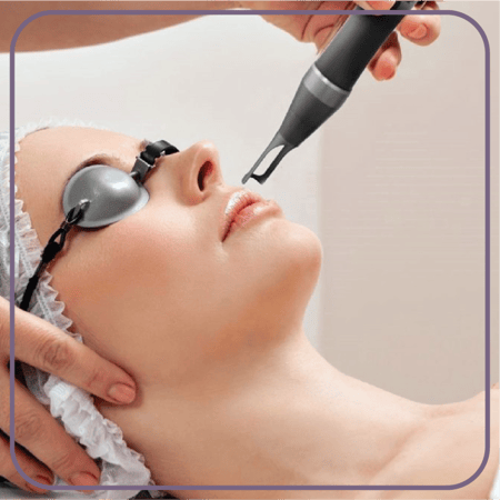 جلسة تشقير الوجه بدون رتوش