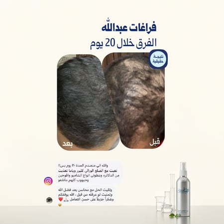 زيت محاسن الشعر