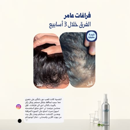 زيت محاسن الشعر