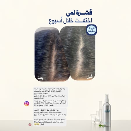 زيت محاسن الشعر