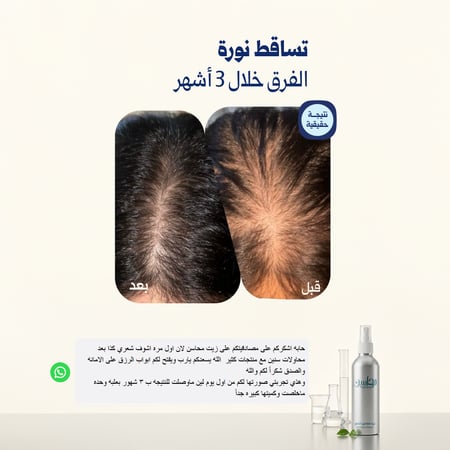 زيت محاسن الشعر