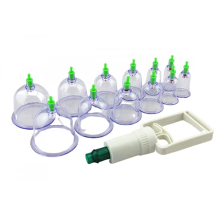 كاسات الحجامة الإسلامية