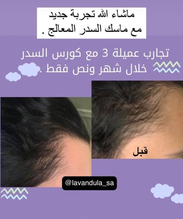 كورس السدر بالاعشاب المتكامل