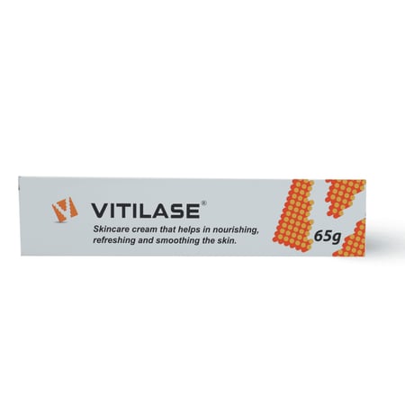 Vitilase, Cream, For Vitiligo Symptom